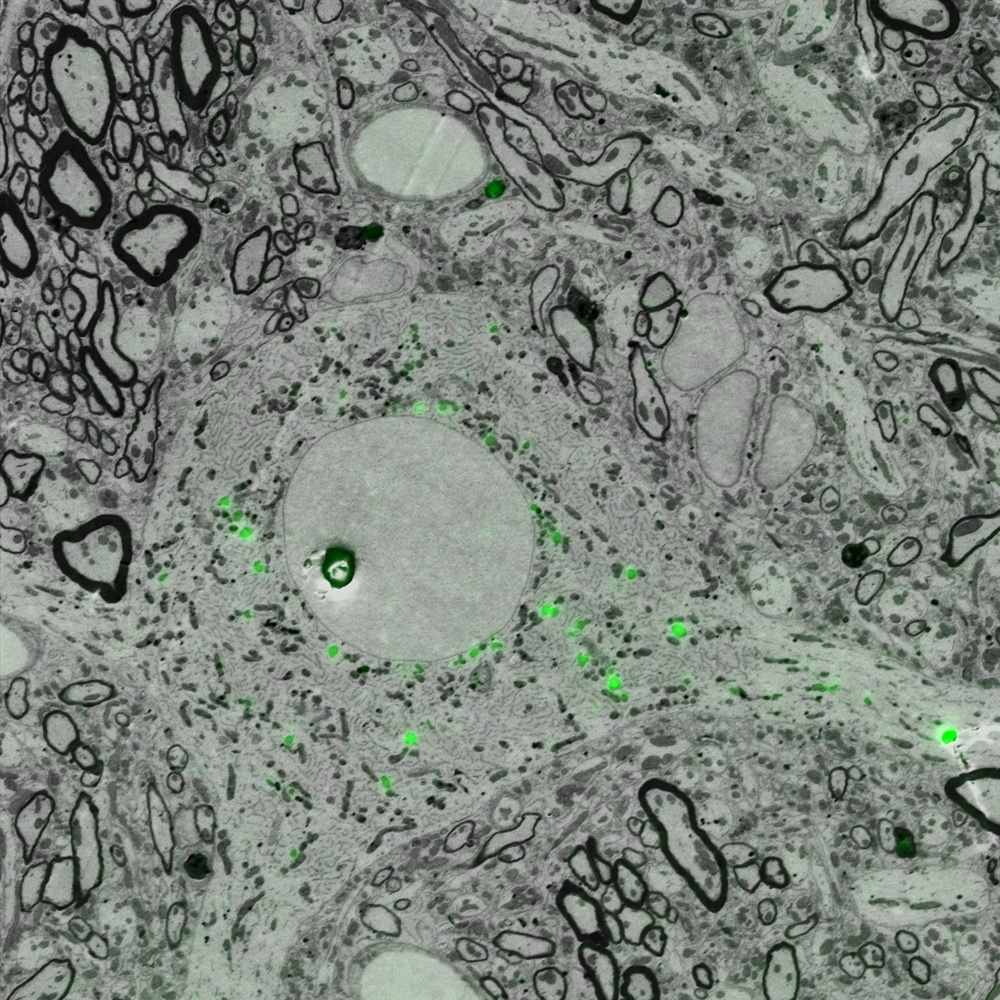 Correlative Light And Electron Microscopy Fundamentals